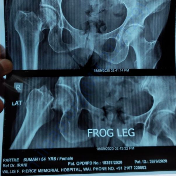 X Ray