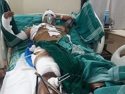 Ebenazer Thanganadar Needs Your Urgent Support In Fighting Road Traffic Accident With Leg Injury