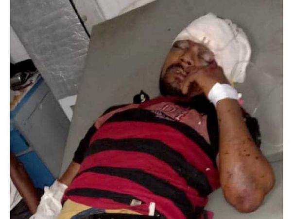 Please Help Mantu Chauhan who met with an Accident