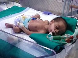 This 10 Days Old Needs Your Urgent Support In Fighting Hydrocephalus