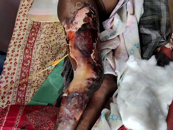 Help Chintha Kishore