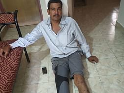 I Need Your Urgent Support In Fighting Diabetic Gangrene Of Toes