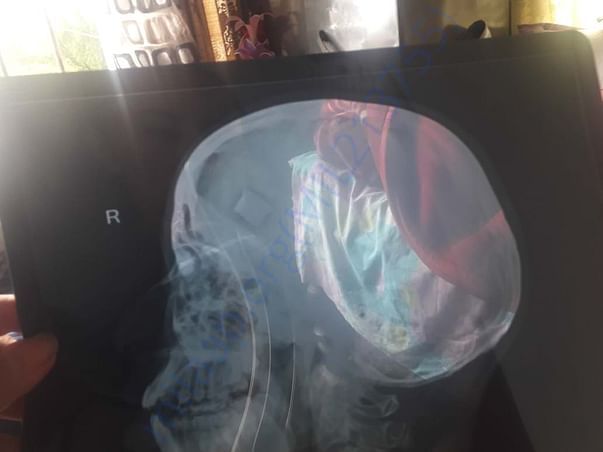 CT scan 1