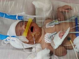 This 13 Days Old Needs Your Urgent Support To Undergo NICU Care