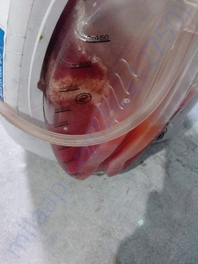 Dirty blood and pus coming from the wound
