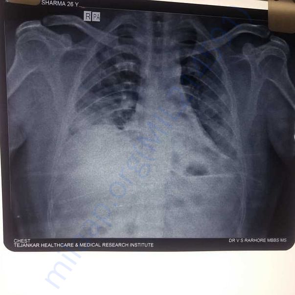 X Ray Report