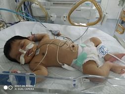 Support Baby Of K Saidevi Recover From Heart Disease