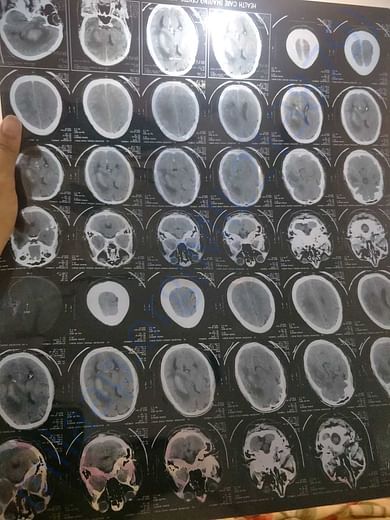 X-Ray report