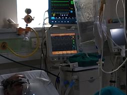 UNCLE is in ICU for last 80days due to covid19.