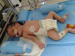 This 28 Days Old Needs Your Urgent Support To Undergo NICU Care