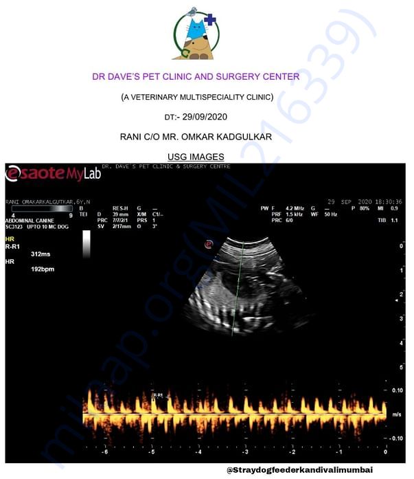 Sonography