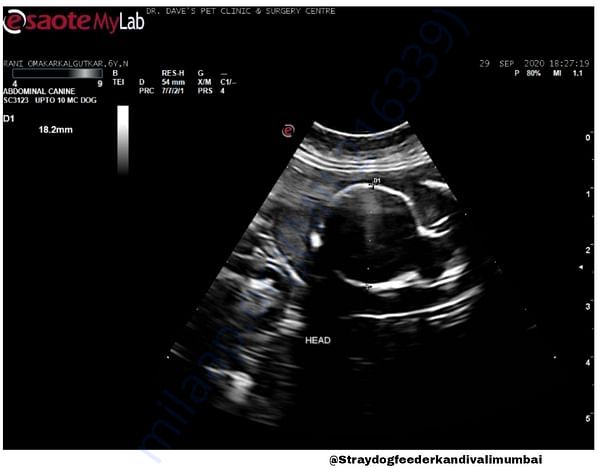 Sonography