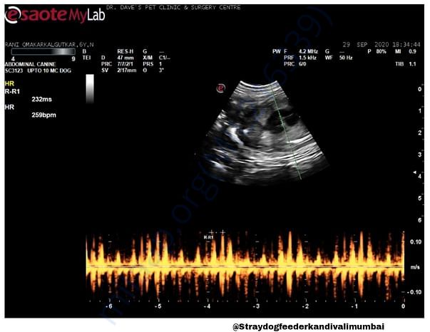 Sonography
