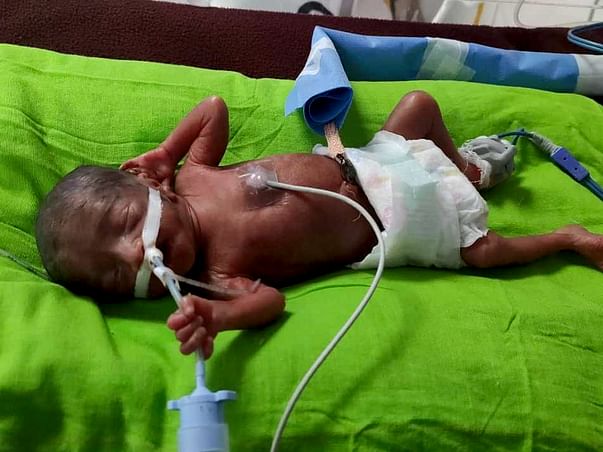 Help my premature baby