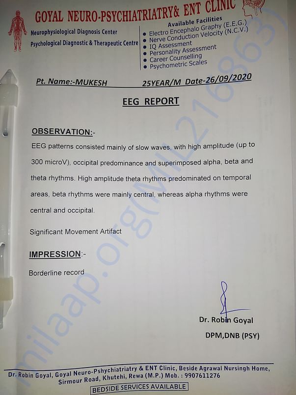 ECG report