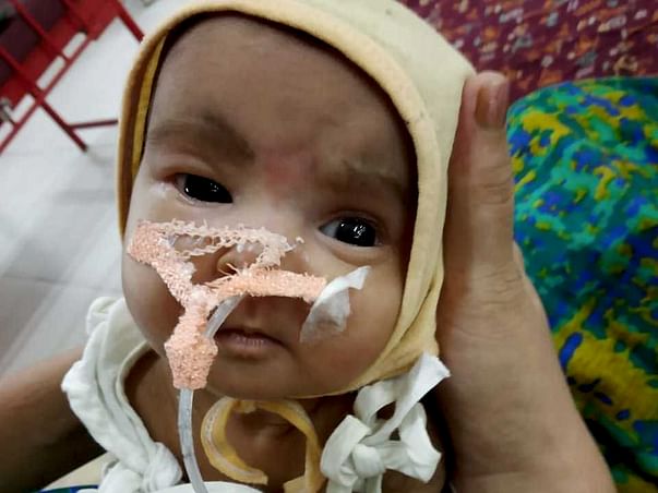 This 3 months old needs your urgent support in fighting Retinopathy of prematurity