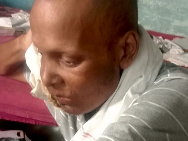 Support Subhash Jha Recover From Oral Cancer