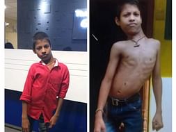 Support Yuvaraj - Spinal Disorder surgery