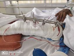 Support Raju Recover From Accident