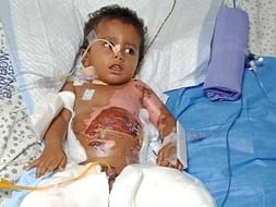 My son is in the ICU battling for his life and needs your help