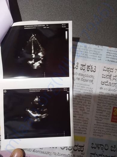 Xray