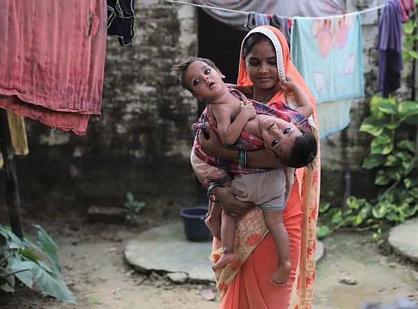 Help These Conjoined Twins Undergo Surgery | Milaap