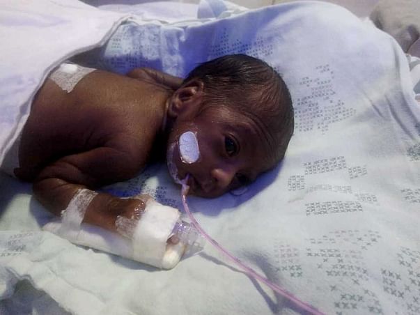 My Daughter Is Born Preterm ,Help Her