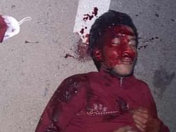 Support Sairaj Recover From Accident Head Injury