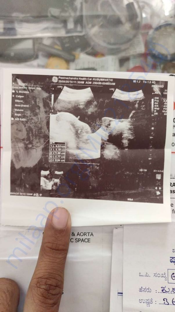 Lab Report 2
