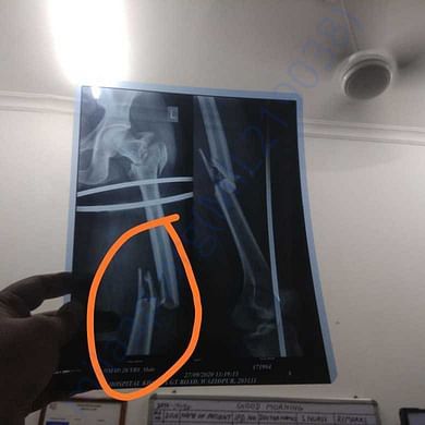 Medical Report