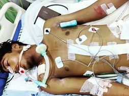 Support Deepak Recover From Accident Multiple Injuries
