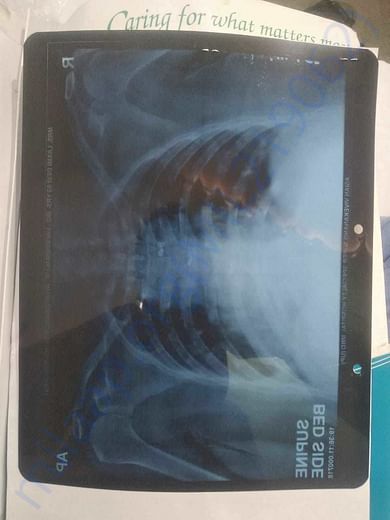 Hospital Reports