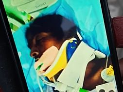 Support Eswaramma Recover From Brain TB and Multiple Organ Disorder