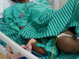 Help Bakiyaraj to recover blood leaks from brain