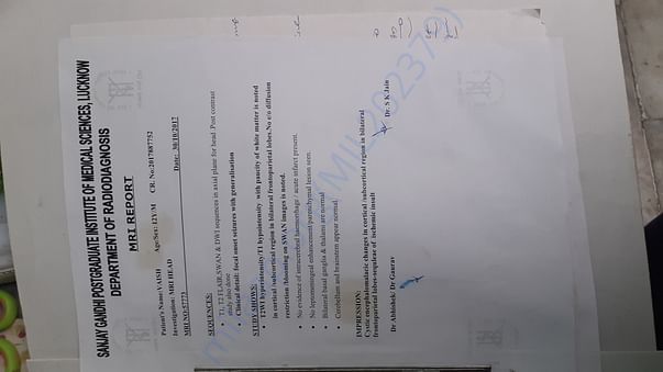 MRI report of Owais in SGPGI