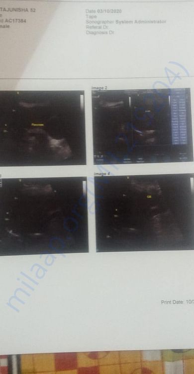 Scan documents
