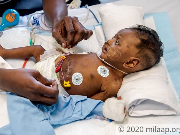 3-Month-Old’s Parents Fear That His Stomach Will Burst Open