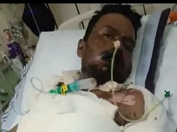 Help Sanjay Fight Steven Johnson Disease🙏
