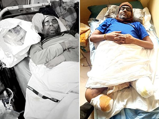 Help Kamlesh to recover after losing both of his legs