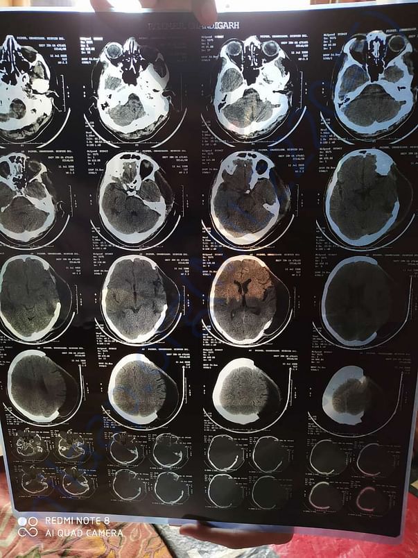 brain scans