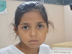 10 years old Swaleha Ahmed needs your help fight mandibular tumor