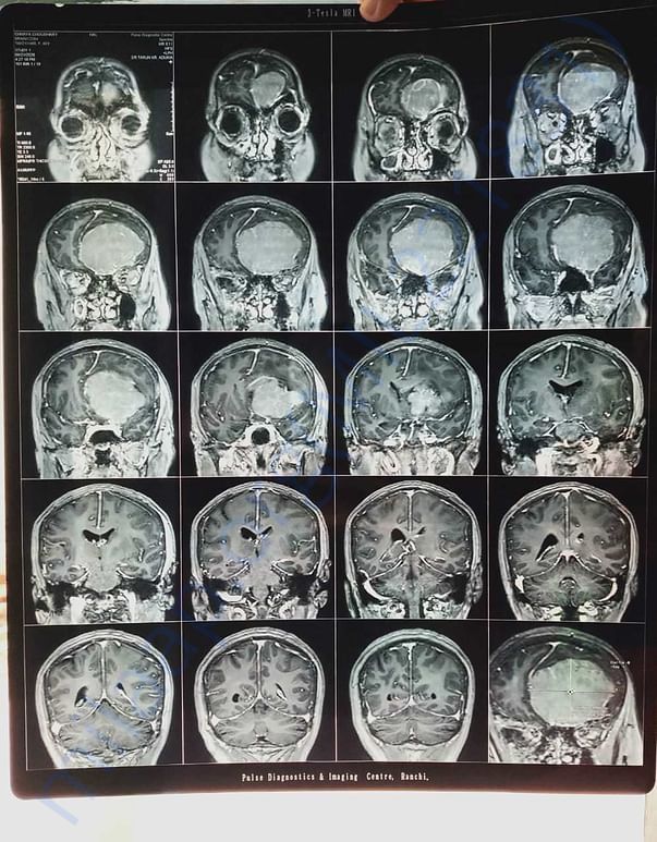 one of the image of MRI