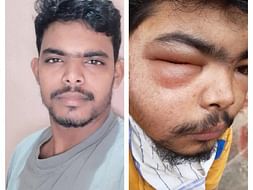 Help Sharath Fight Cancer