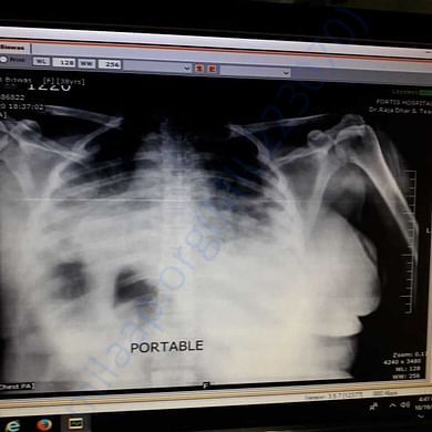 Medical Report