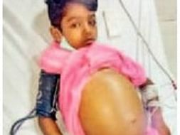 Help Child Raajaaryan Jadhav for Liver Replacement Surgery