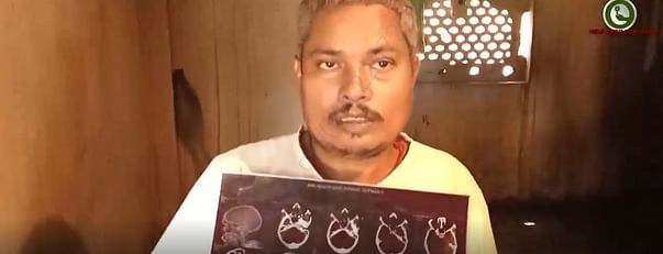 Gajendra Das, Post Traumatic condition, severe accident