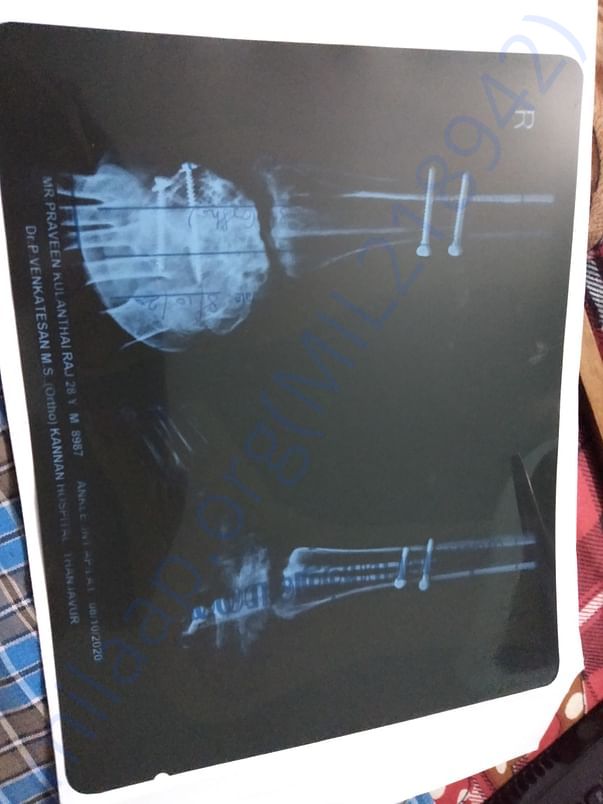 X RAY Current Position Of muscle