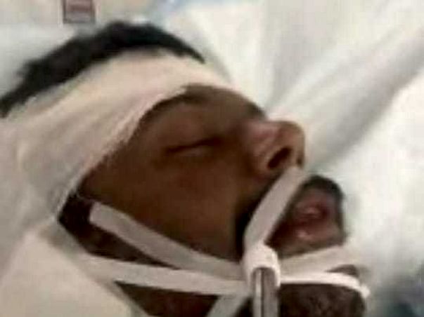 Help!! My Husband had serious head injury after accident