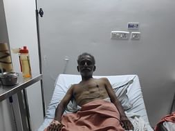 My Relative Is Struggling With Amputation Due To Diabetic, Help Him