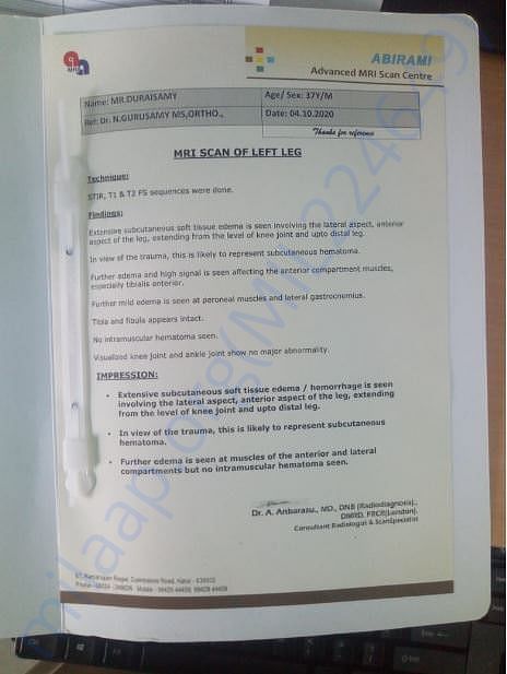 MRI SCAN Result